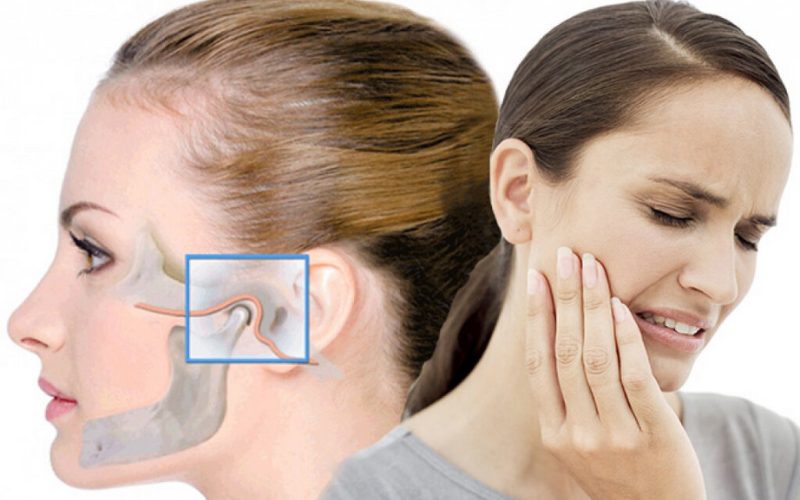 Top Tmj Treatment Trends: What’s New In Jaw Pain Relief?