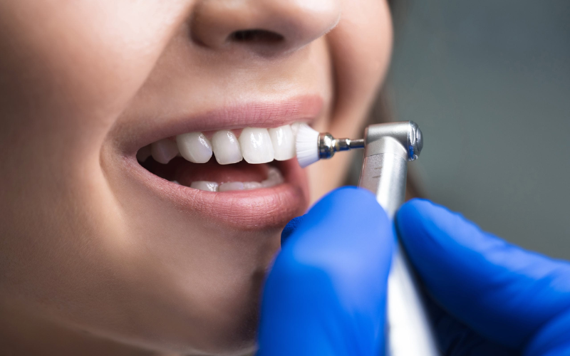 Connection Between Dental Cleaning and Botox