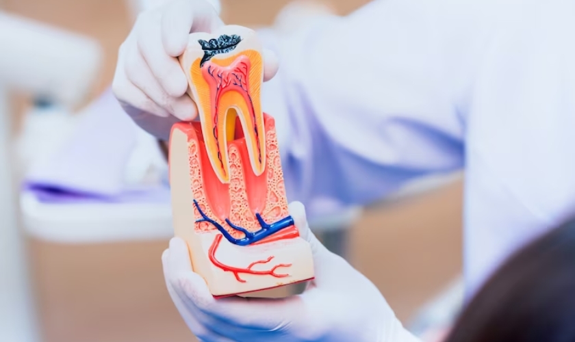 root canal treatment